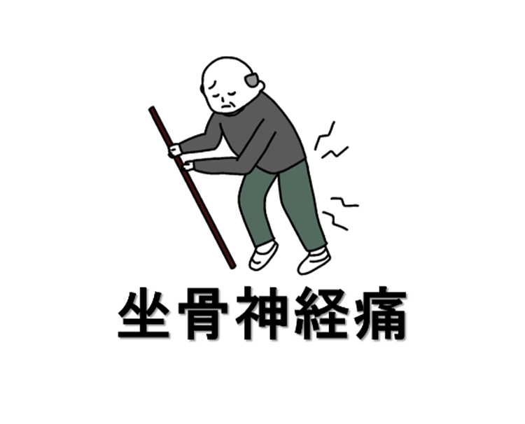 坐骨神経痛