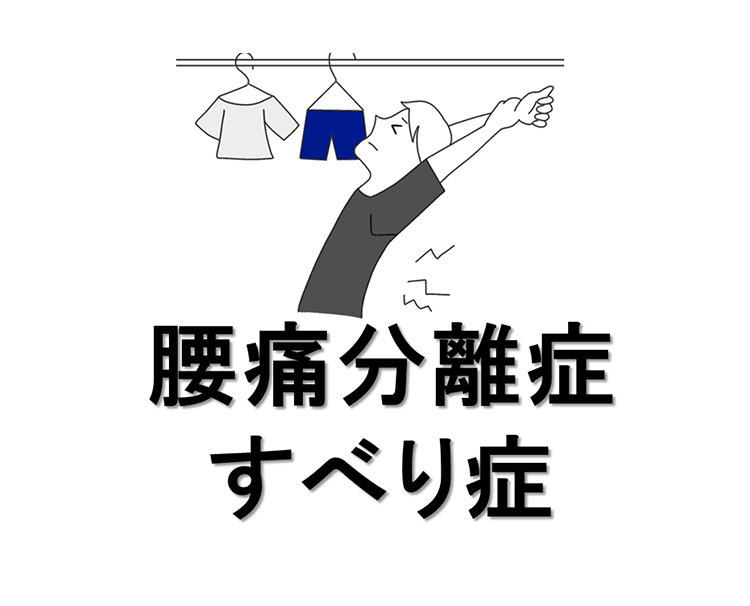腰椎分離症・すべり症